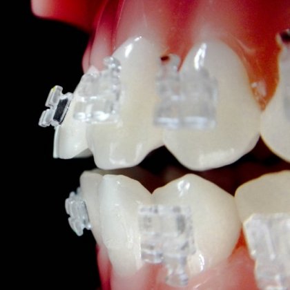 BRACKET ESTÉTICO DE ZAFIRO